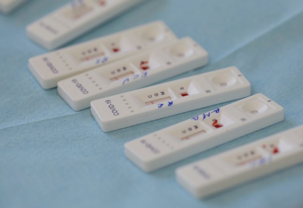 Începe distribuirea primelor 300.000 de teste rapide antigen la nivel naţional