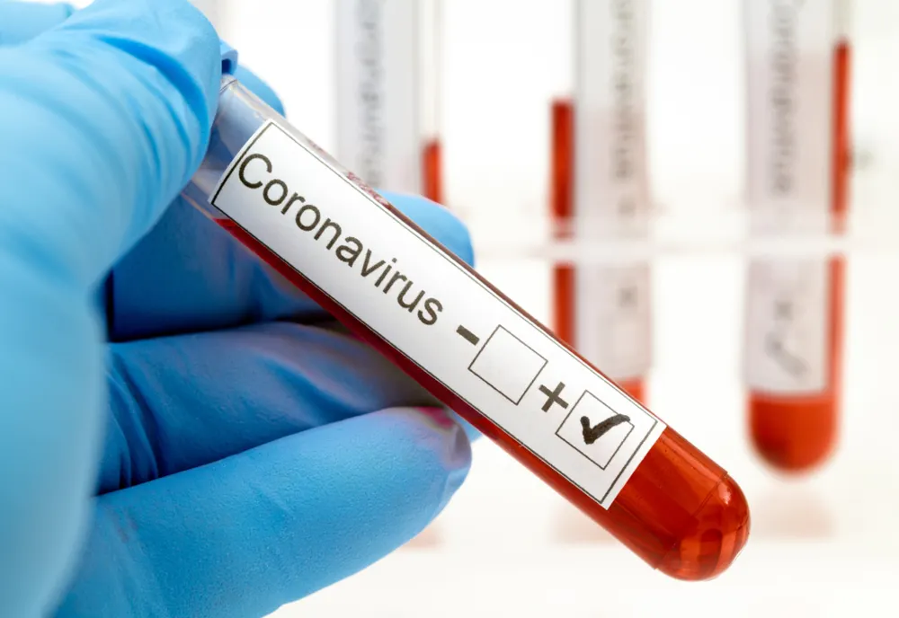 266 de cazuri de coronavirus în județul Constanța 