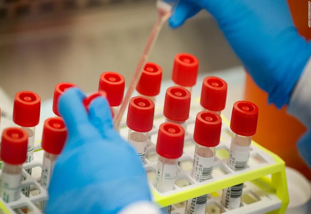 Încă doi constănțeni confirmați cu coronavirus. În total, 278