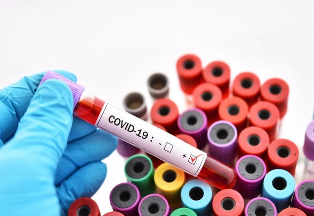 542 cazuri de coronavirus în județul Constanța. Situația în țară