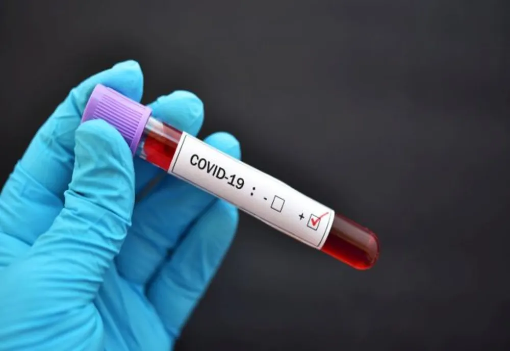 Bilanț coronavirus 21 ianuarie: 2.878 cazuri noi și 69 decese