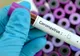Patru noi cazuri de coronavirus confirmate la Contanța