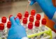 Încă doi constănțeni confirmați cu coronavirus. În total, 278
