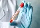 Alertă într-un cămin de bătrâni din Mangalia. O îngrijitoare, confirmată cu coronavirus