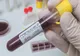 Bilanț coronavirus 28 august: 1.318 cazuri noi, 48 de decese și 497 persoane internate la Terapie Intensivă